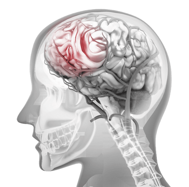 Neuro Vascular